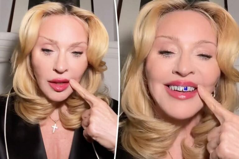 Madonna reveals off wild lapis-and-diamond grills on TikTok Madonna reveals off wild lapis-and-diamond grills on TikTok