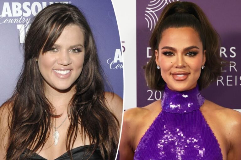 Khloé Kardashian reveals each beauty process and surgical procedure she’s had performed