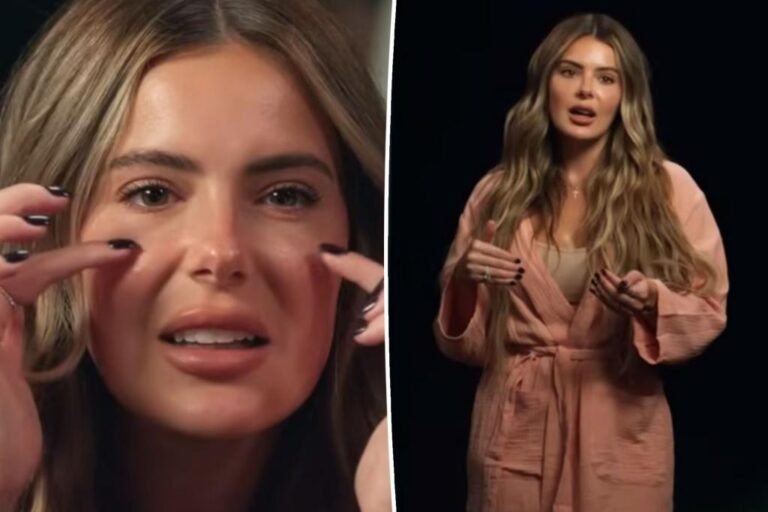 Brielle Biermann admits regrets over getting filler at younger age