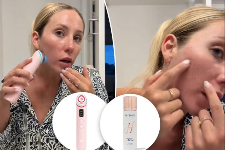 Alix Earle shares replace on her zits battle and present skincare routine