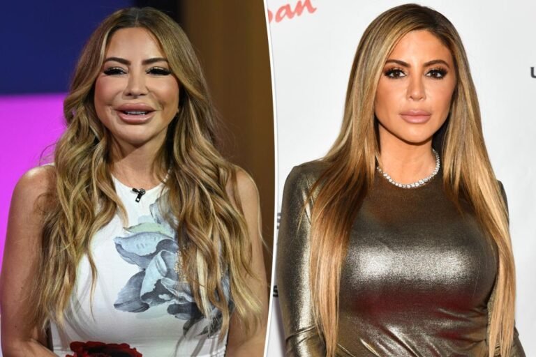 Larsa Pippen blames ‘allergic response’ for stunning face transformation