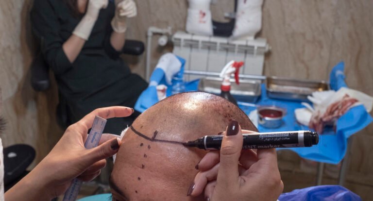 Man Dies Throughout Prep Part In Turkey